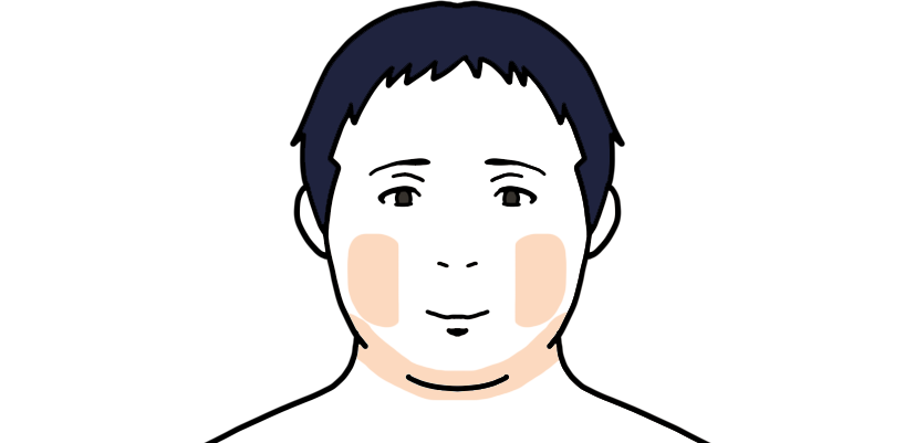 全顔（頬～顎下）