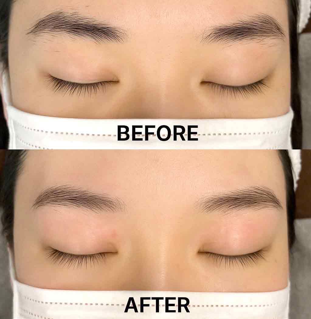 症例写真