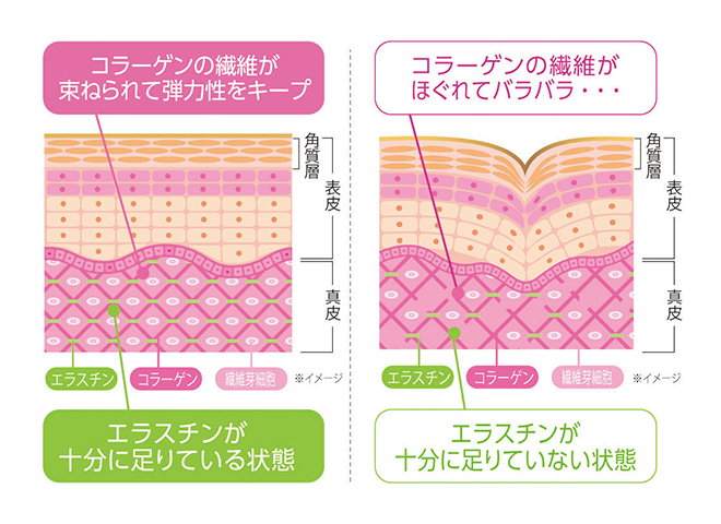 エラスチン減少によるトラブル