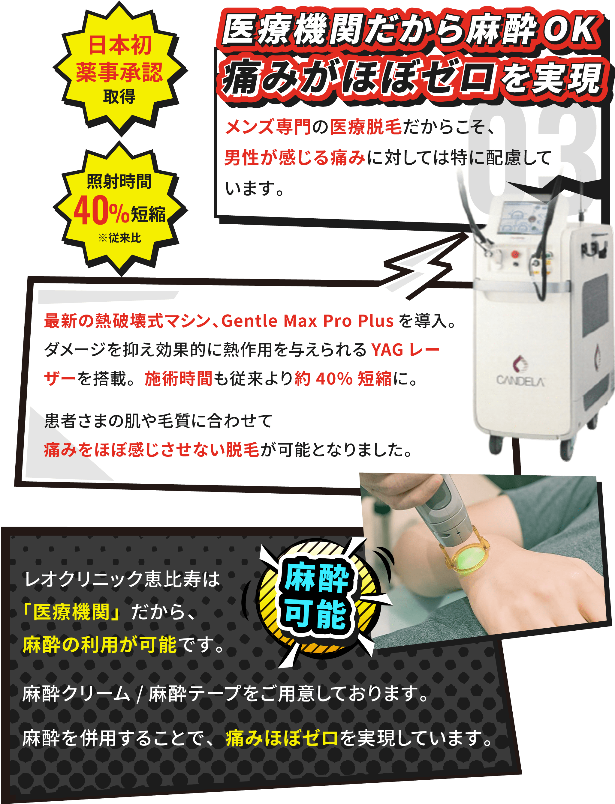 医療機関だから麻酔OK。最新のGentle Max Pro Plusを導入し、施術時間も従来より約40%短縮に。