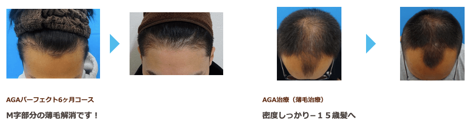 TCB東京中央美容外科町田院の実際の治療写真