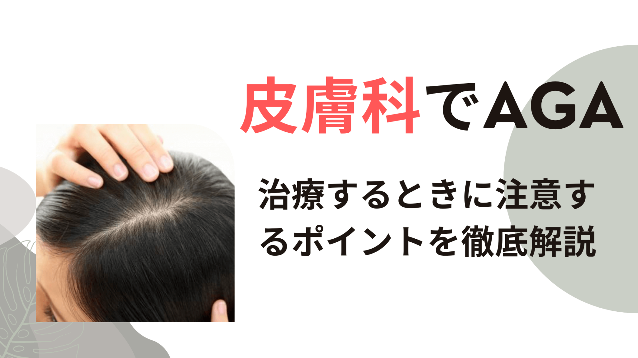 【徹底解説】AGA治療を皮膚科でするときに絶対しておくべき4つのこと 診療比較ナビ
