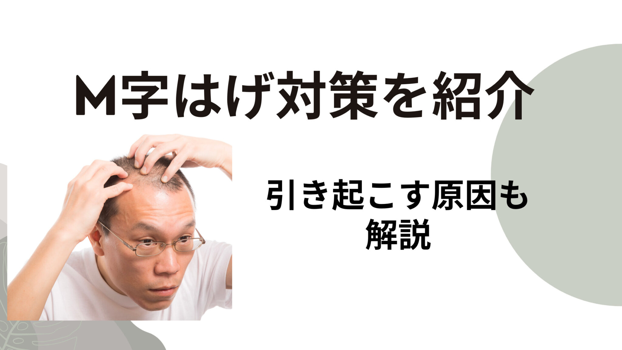 M字はげの対策と引き起こす原因を紹介！治らないって本当？ - 診療比較ナビ